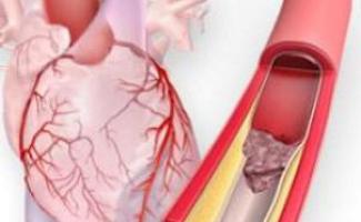 “Сердечный приступ: предвестники, симптомы — что делать, чтобы сохранить жизнь?